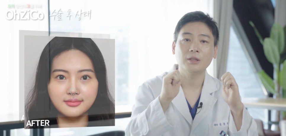 짧은코수술 후기까지 자세하게 알아보고 관련 이미지 8