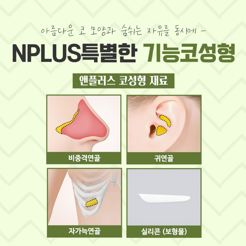 Rhinoplasty for Rhinitis at a Good ENT Clinic image 9