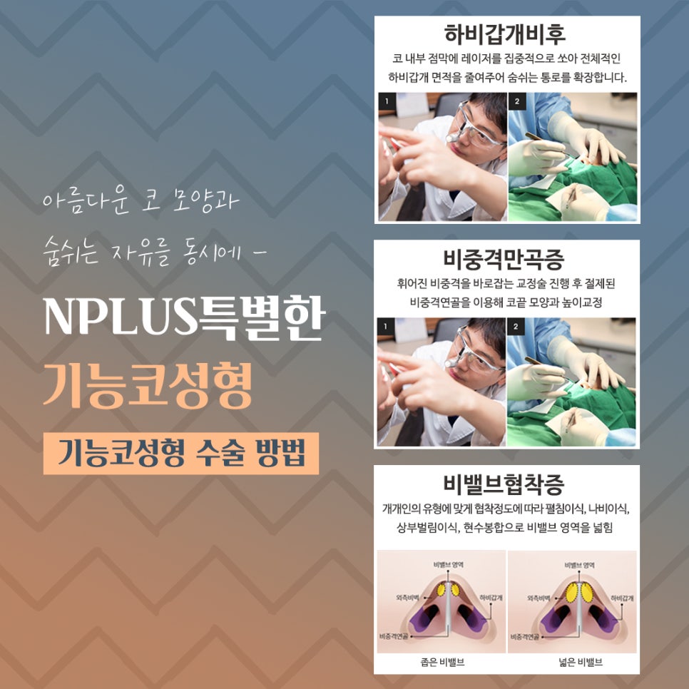 기능코후기에 대한 비교를 찾아보고 관련 이미지 8