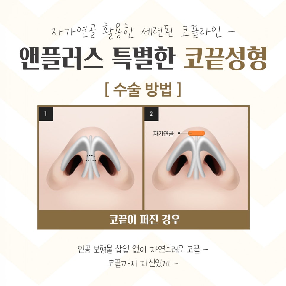 코끝수술후기 다양한 정보를 알아보고 관련 이미지 9