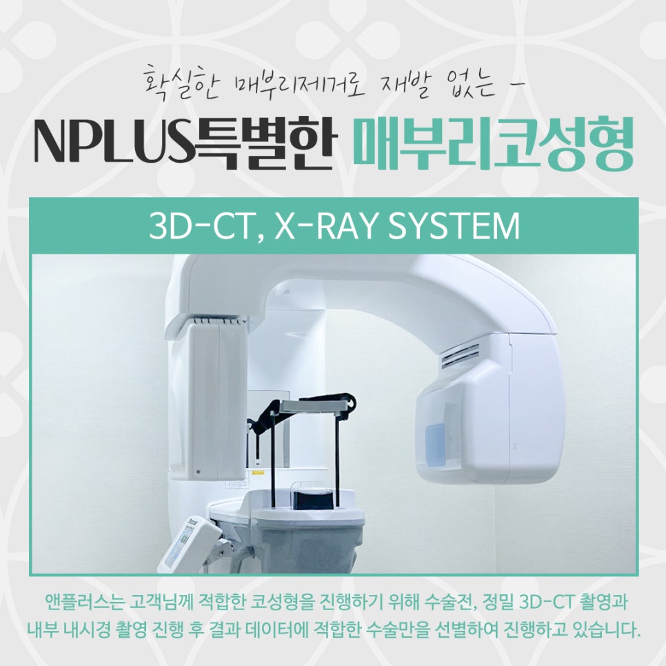 매부리코성형후기 부드러운 인상으로 관련 이미지 8