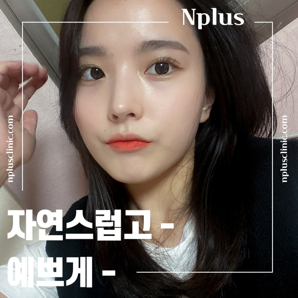 Nose Surgery Review with a Natural Nose Line image 1