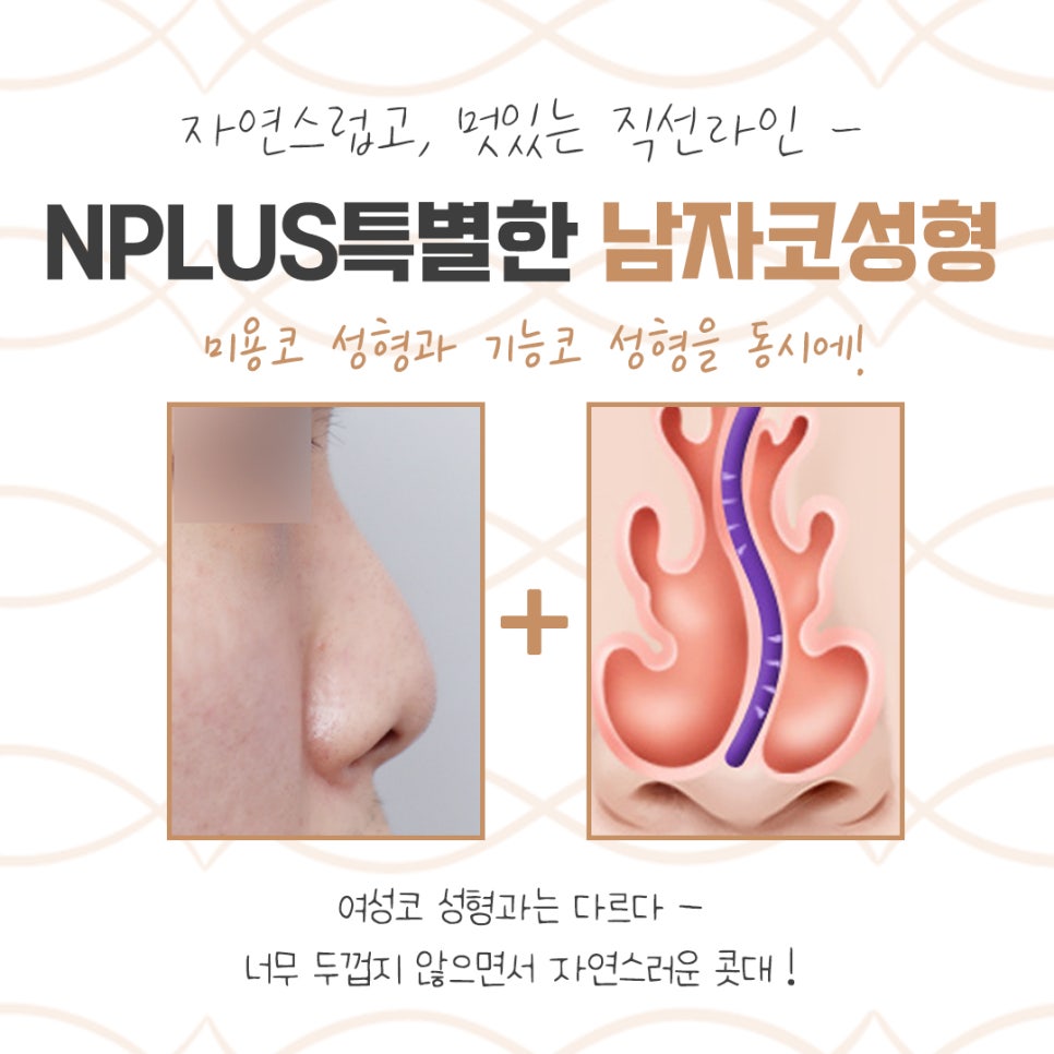 남자코성형전후 확인하고 개선 관련 이미지 4