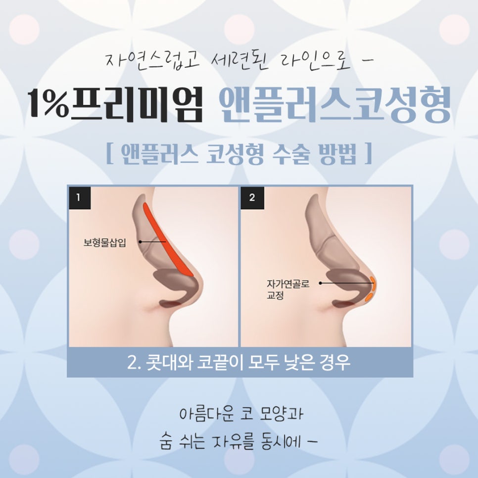 Reviewing and Deciding on Self-Rib Nose Surgery Reviews image 8
