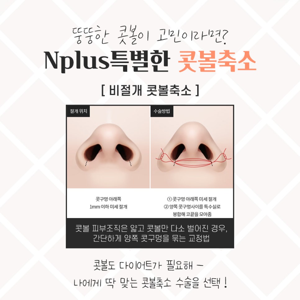 Looking Closely at Nostril Reduction Reviews image 8