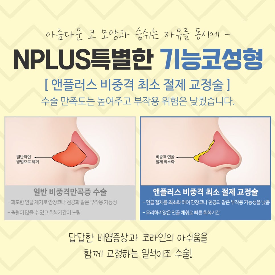 A Clear Choice for Rhinitis Nose Surgery image 10