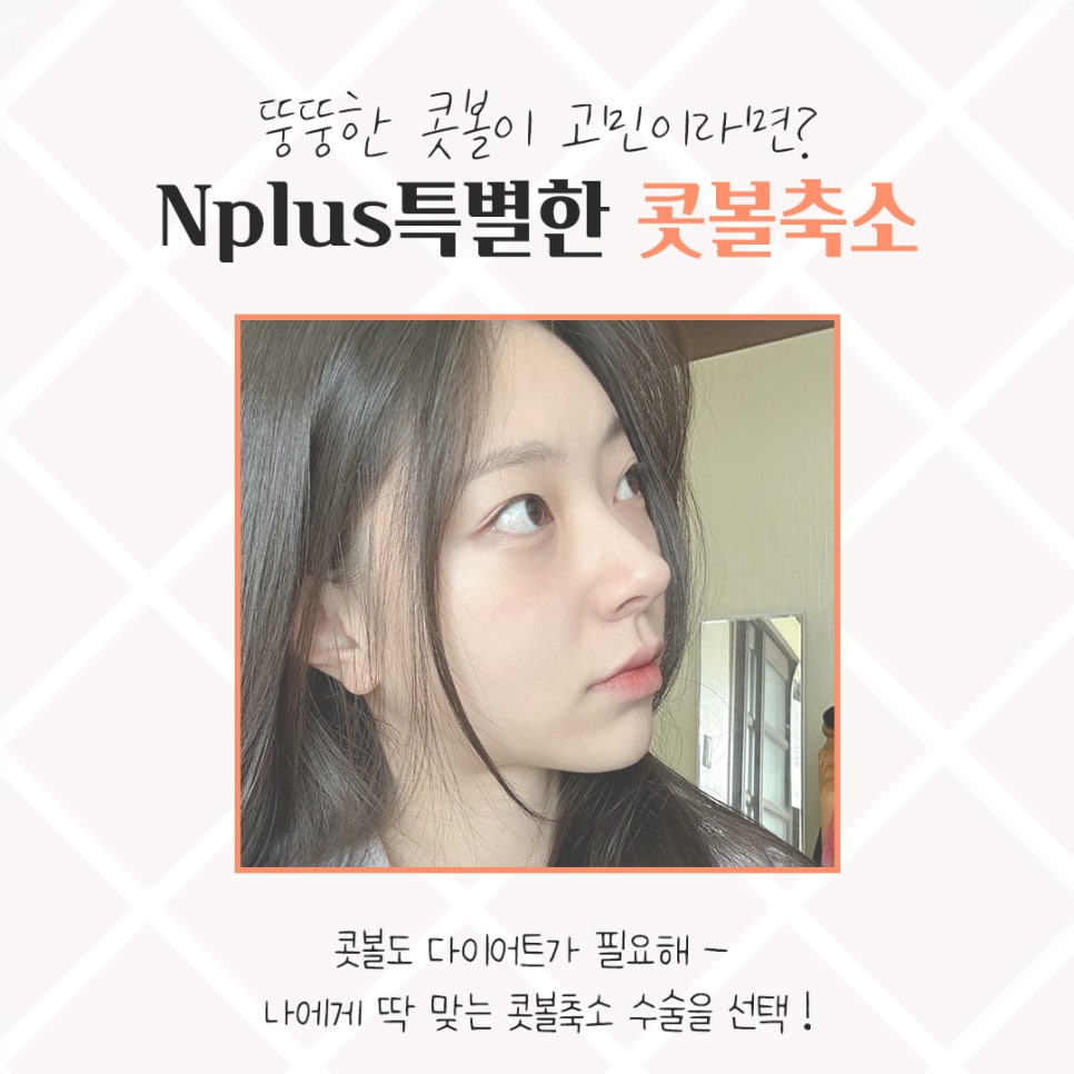 Looking Closely at Nostril Reduction Reviews image 3