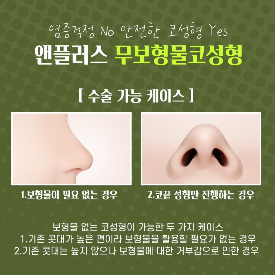 자가연골 활용한 코수술후기 관련 이미지 7