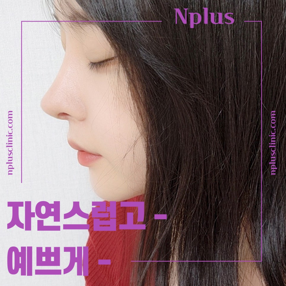 복코수술후기에 대해 세세하게 알아보고 관련 이미지 2