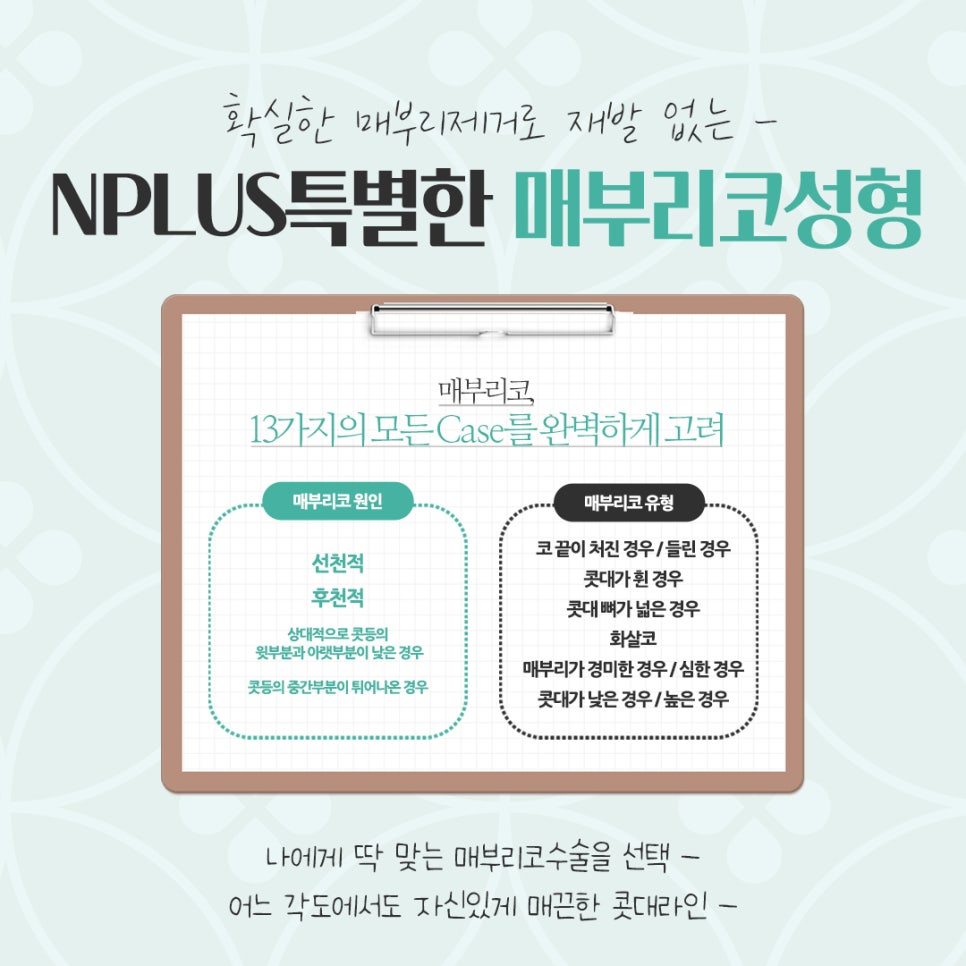 매부리코수술후기 자연스럽고 세련된 라인으로 관련 이미지 4