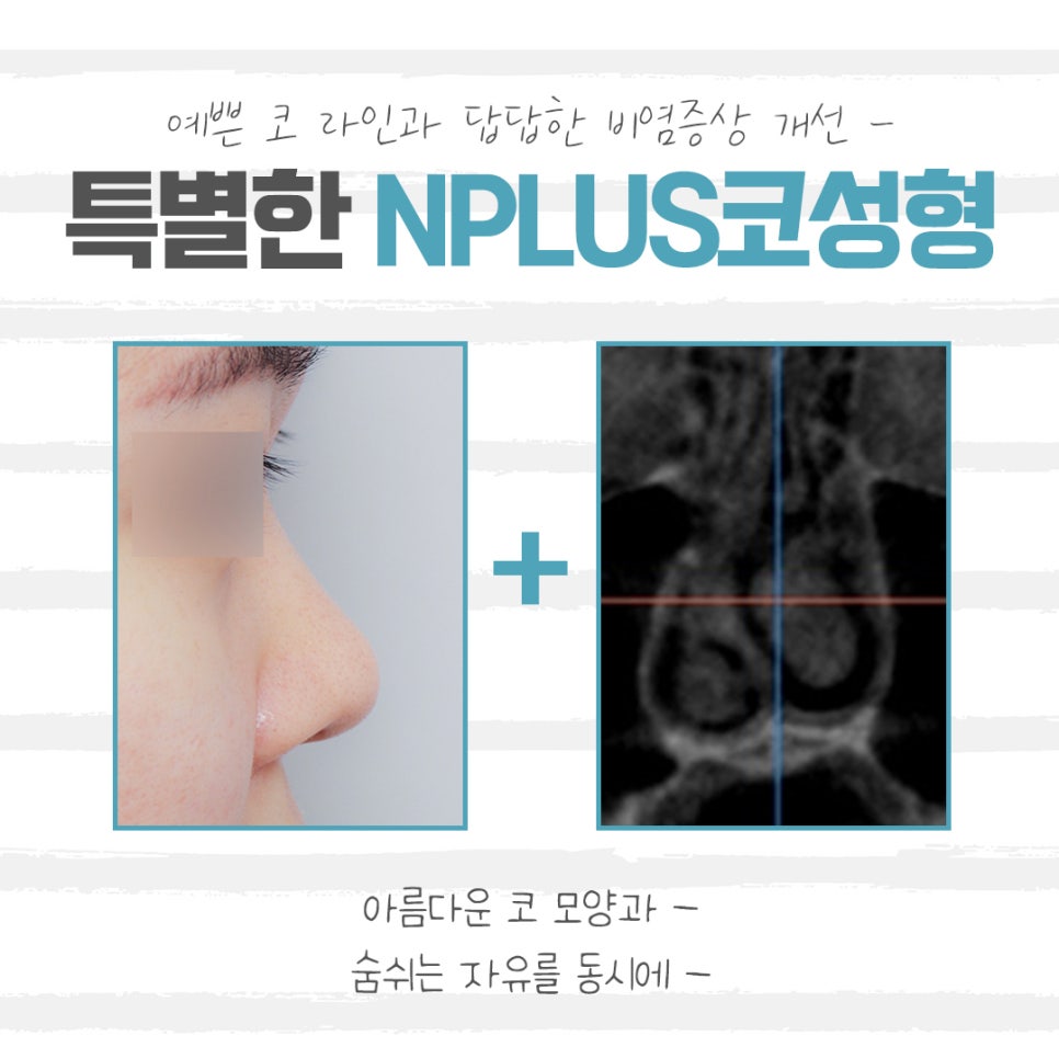 Reviewing Low Nose Surgery Reviews Carefully image 3
