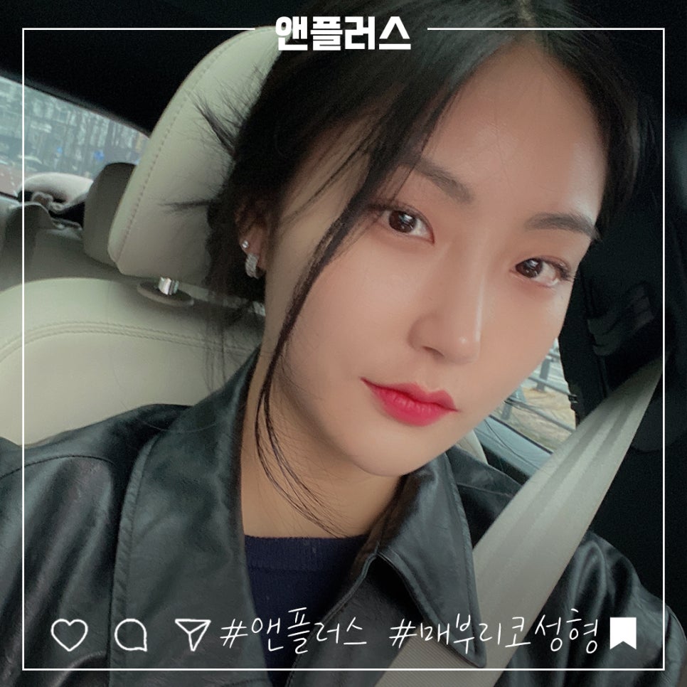 매부리코성형후기 코끝처짐을 개선하여 관련 이미지 8