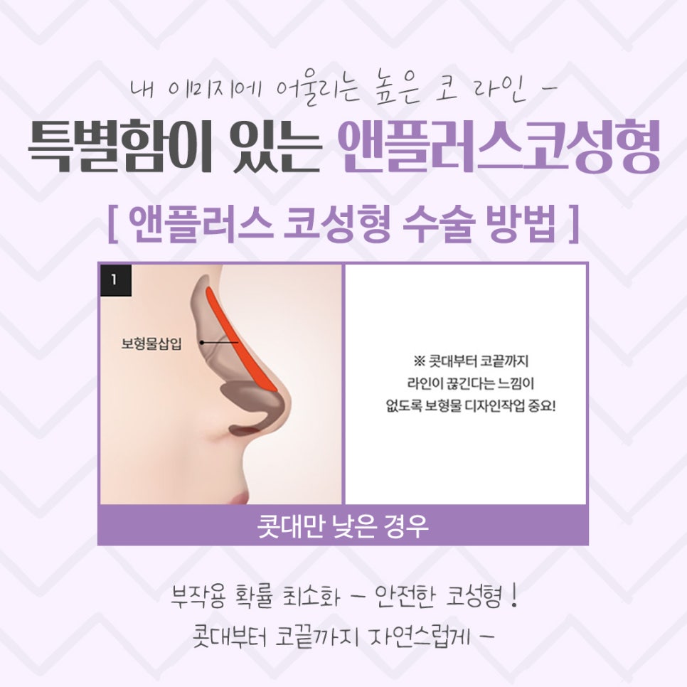 코수술후기를 통해 내게 어울리는 라인으로 관련 이미지 8