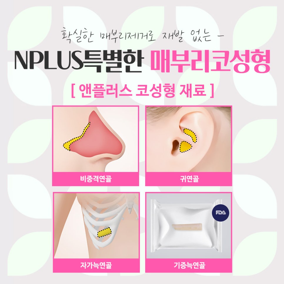 A Refined Look Through Female Hump Nose Surgery image 12