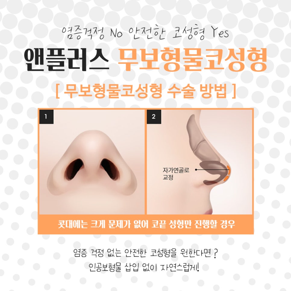 Sophisticated and Natural with Non-Implant Nose Surgery image 9