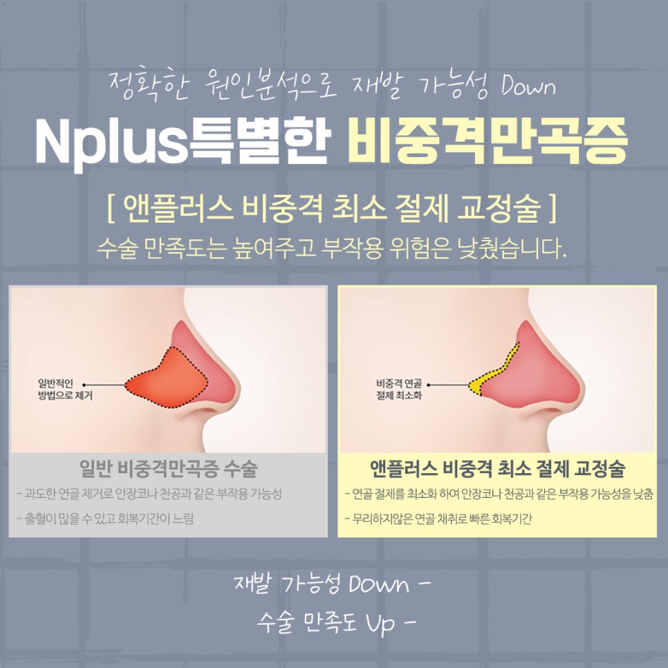 비중격만곡증수술 후기까지 확인하여 관련 이미지 11