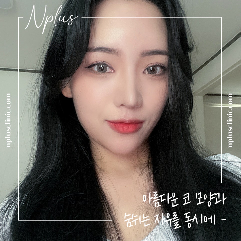 콧볼축소수술 흉터 없이 강남앤플러스에서! 관련 이미지 3