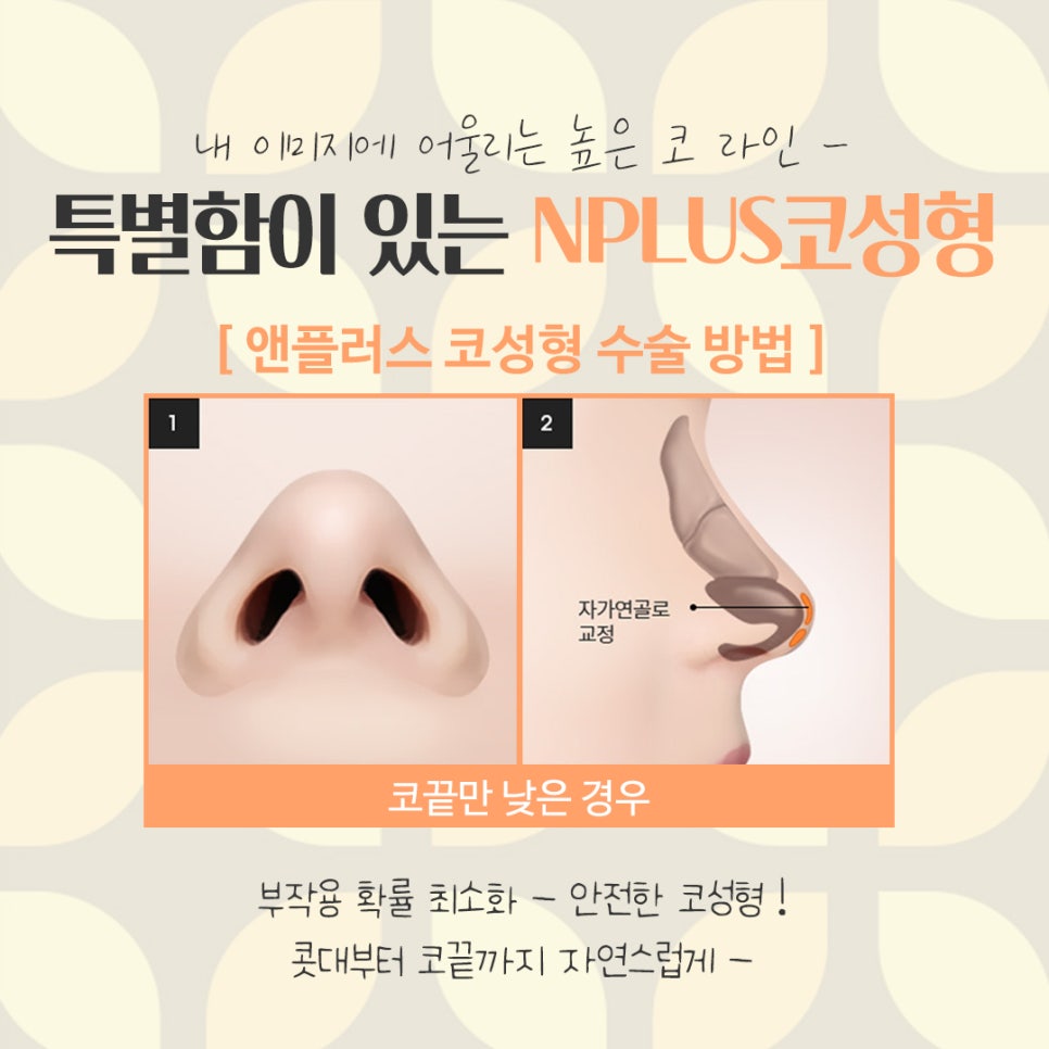 Looking into Reviews of Female Rhinoplasty in Detail image 10