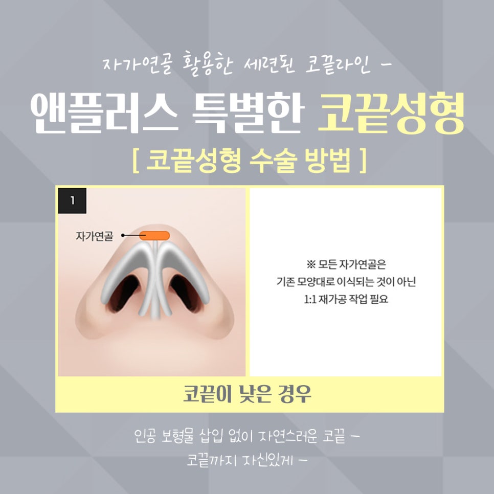 Tip Plasty Through Tip Cartilage Stitching image 7