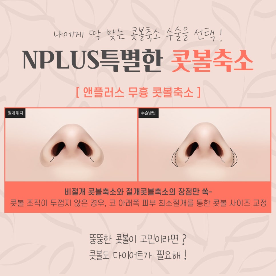 A Review of Nostril Reduction Surgery for a More Refined Look image 7