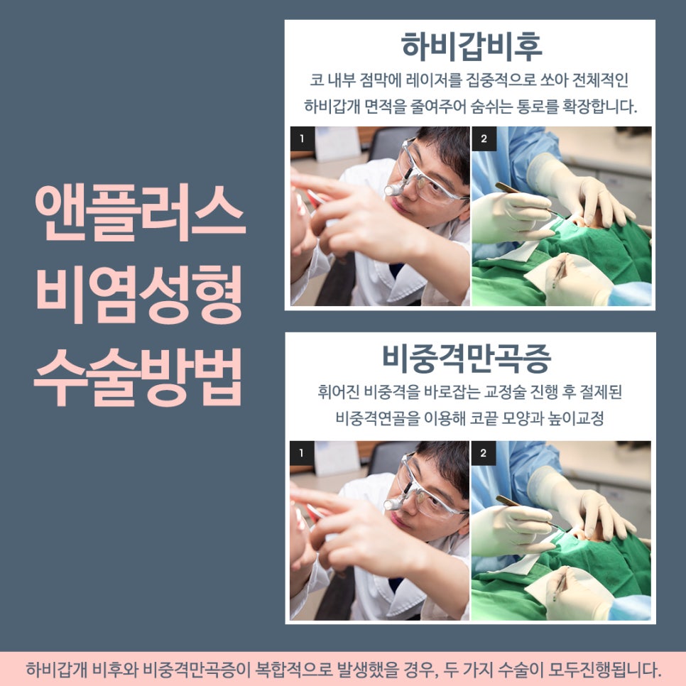 Analyzing the Causes of Rhinitis Surgery to Full Recovery image 6