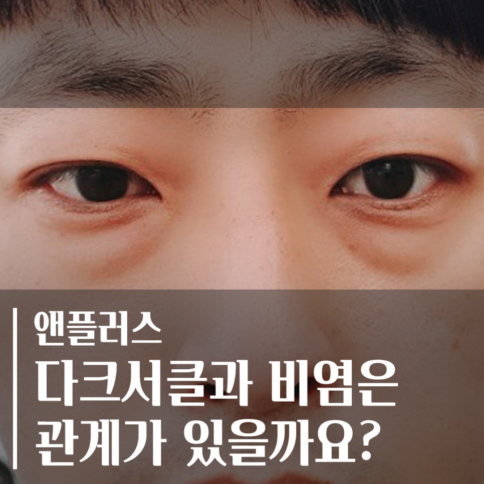 다크서클과 비염! 관계가 있을까요? 관련 이미지 1