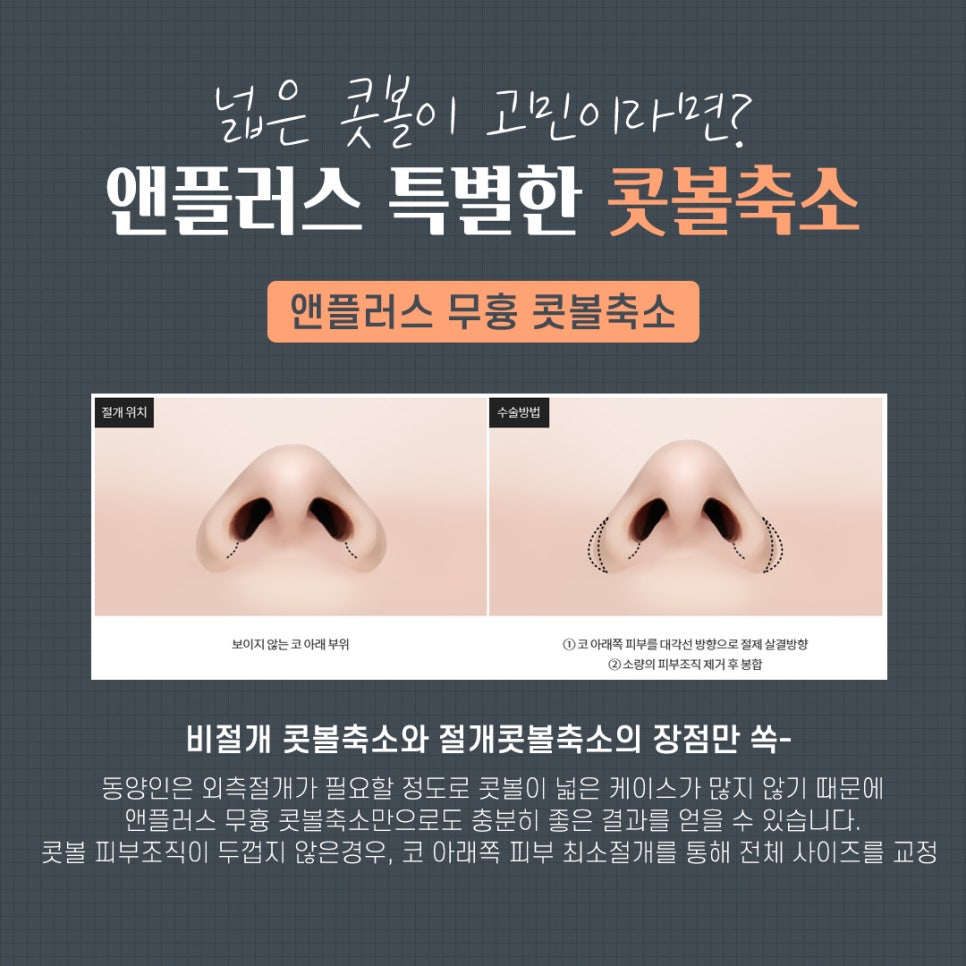 콧볼축소수술 흉터 없이 자연스럽게 관련 이미지 5
