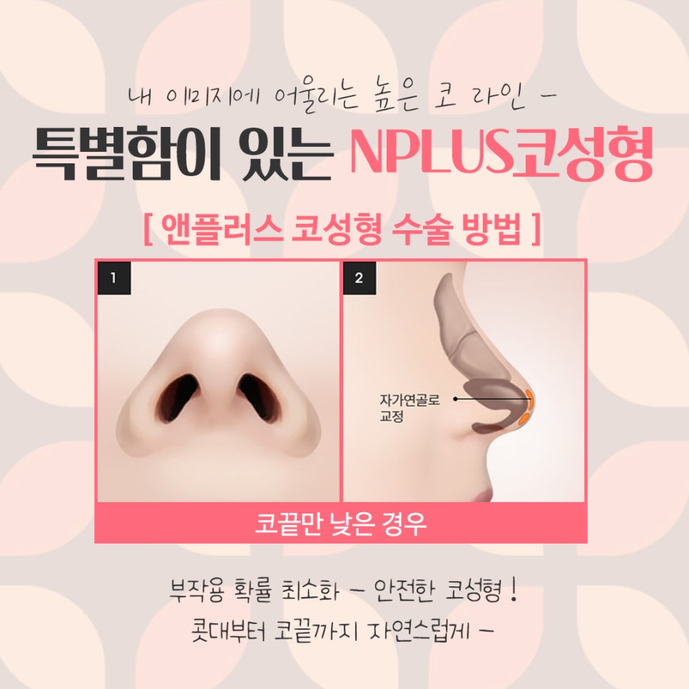 여자코수술후기 정확한 진단으로 관련 이미지 10