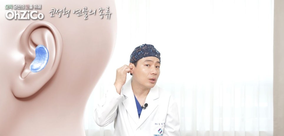 코성형 재료 연골의 종류와 특징! 관련 이미지 5