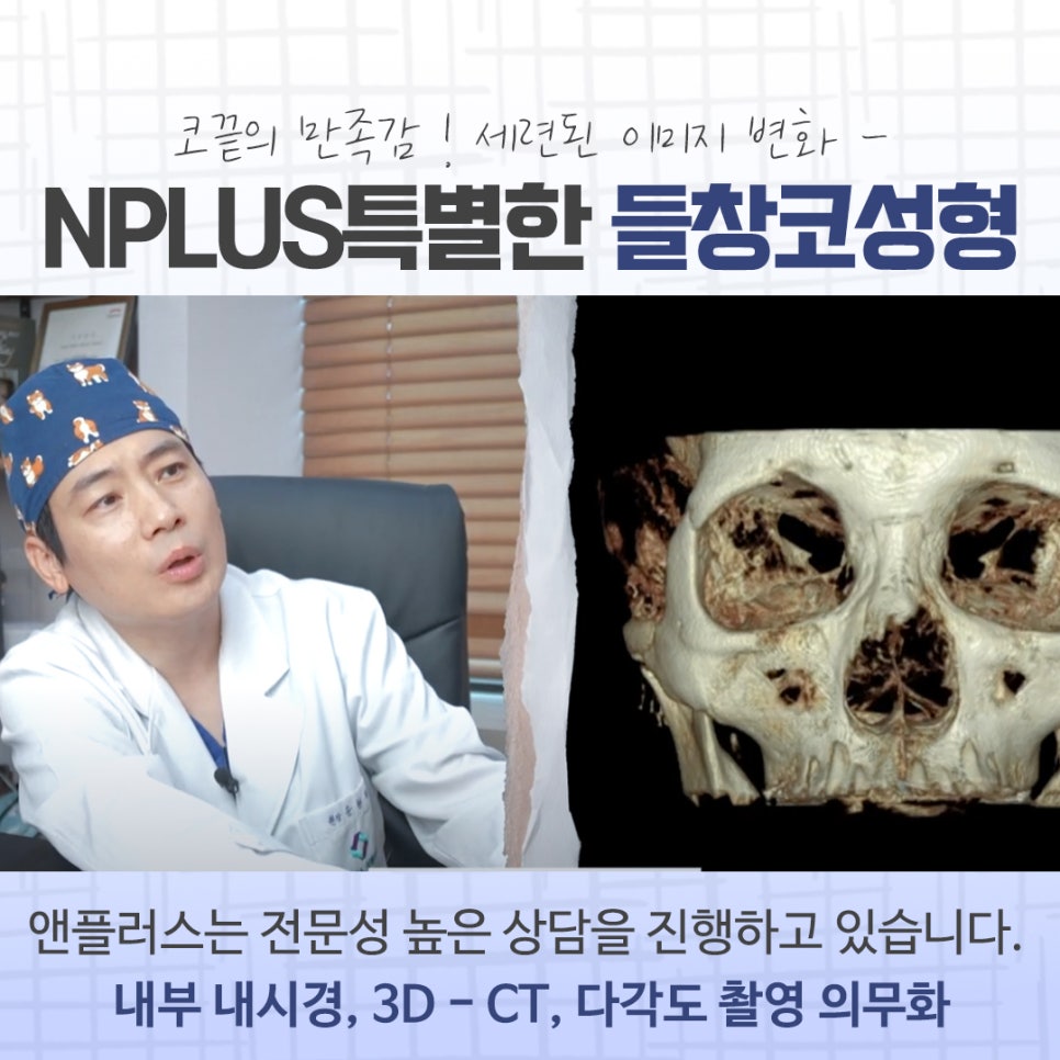 들창코성형 후기를 비교해 보고 관련 이미지 6