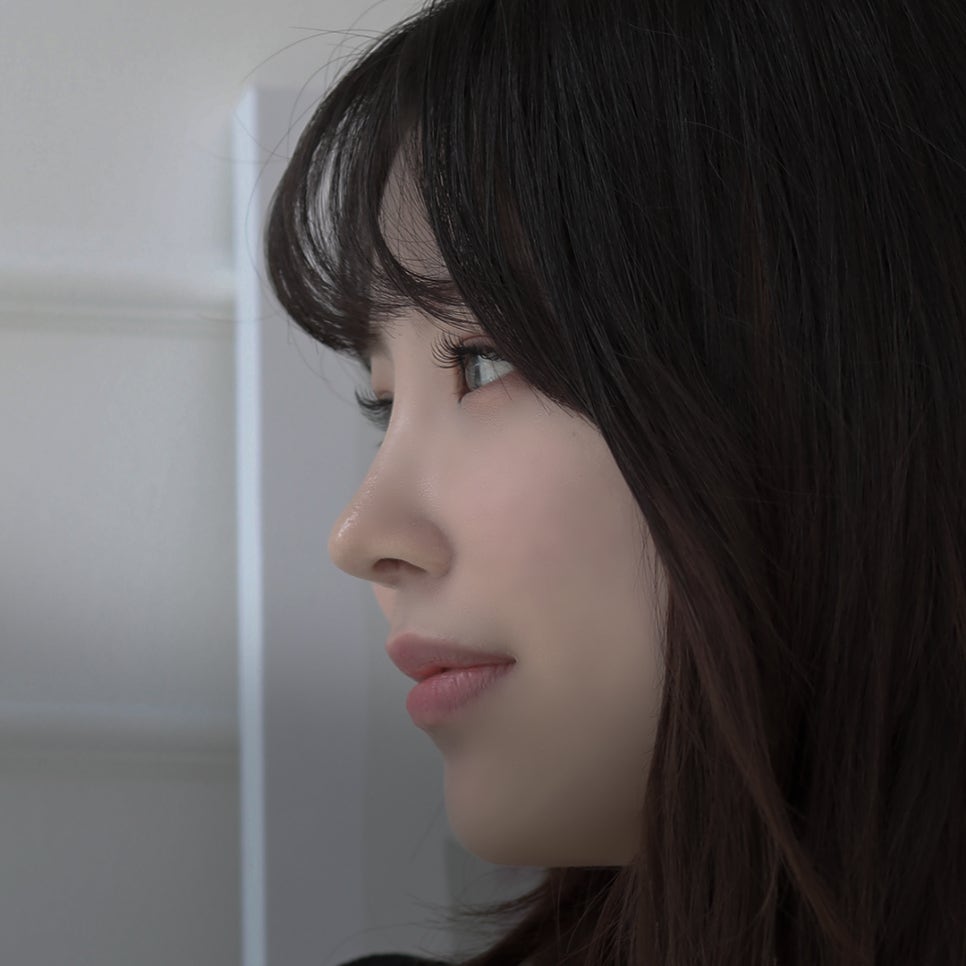 Revision Rhinoplasty Review: A Choice You Won’t Regret image 1
