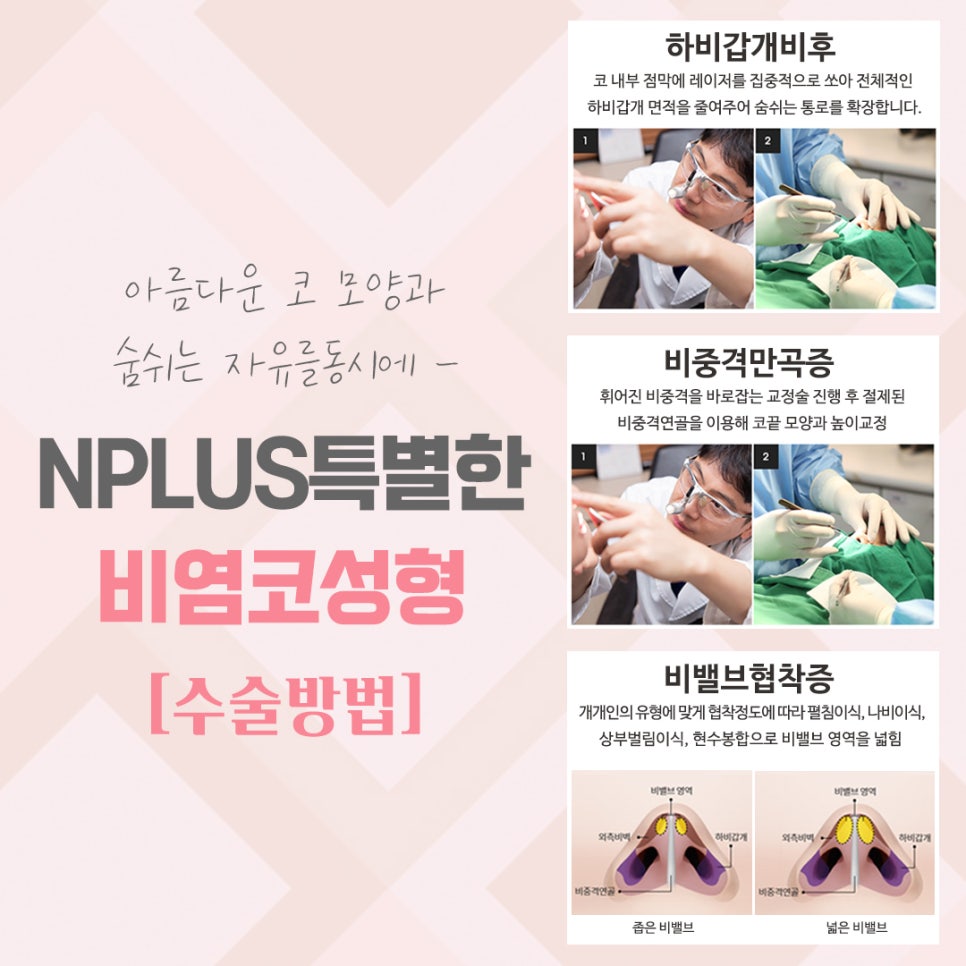 비염코수술후기 확실한 진단으로 관련 이미지 8