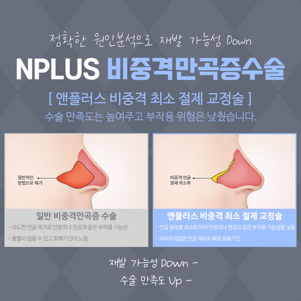 비중격코성형 정확한 원인 파악으로 관련 이미지 11