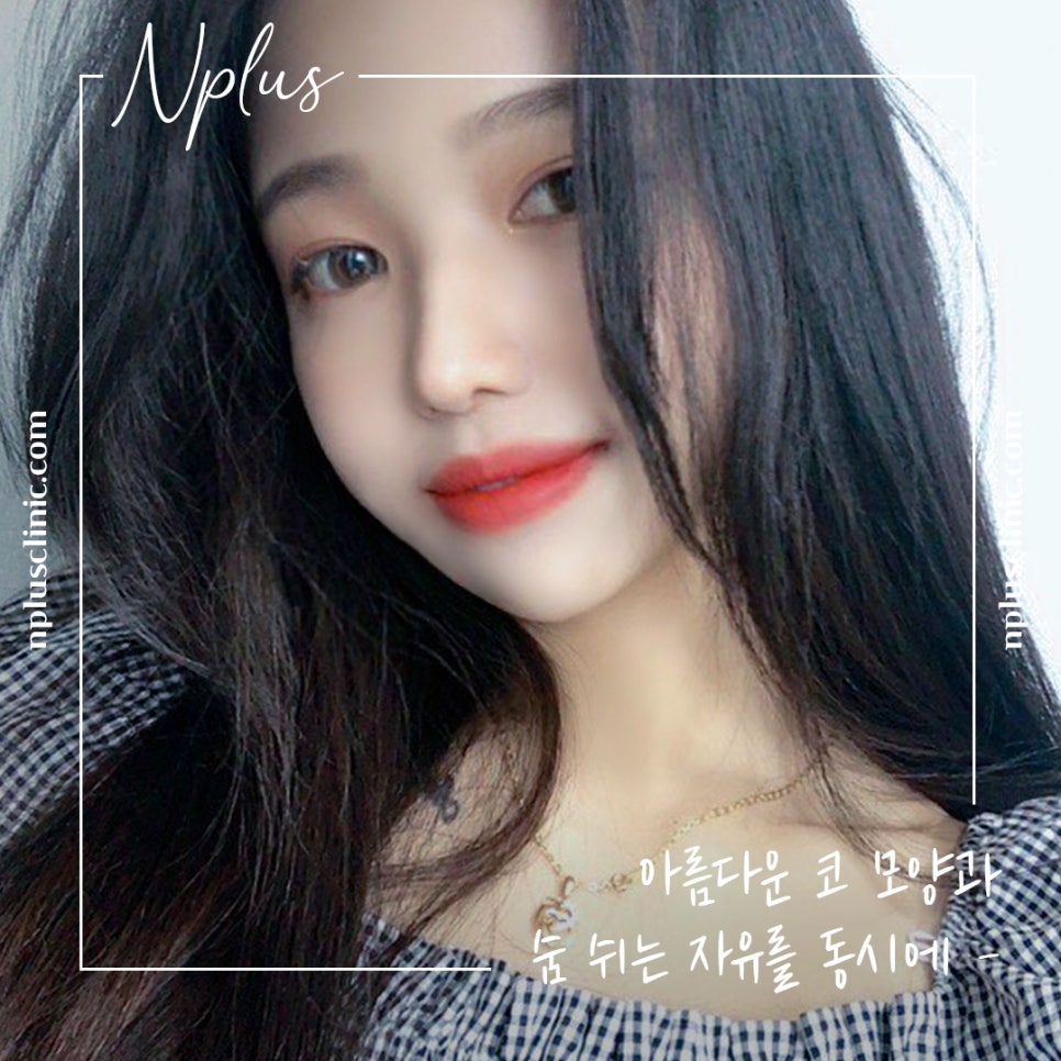 자가늑연골코성형으로 세련된 이미지로 변신 관련 이미지 2