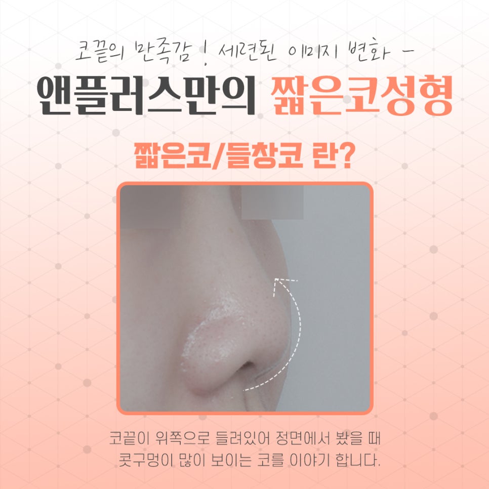 Naturally and Beautifully Through Short Nose Surgery image 5