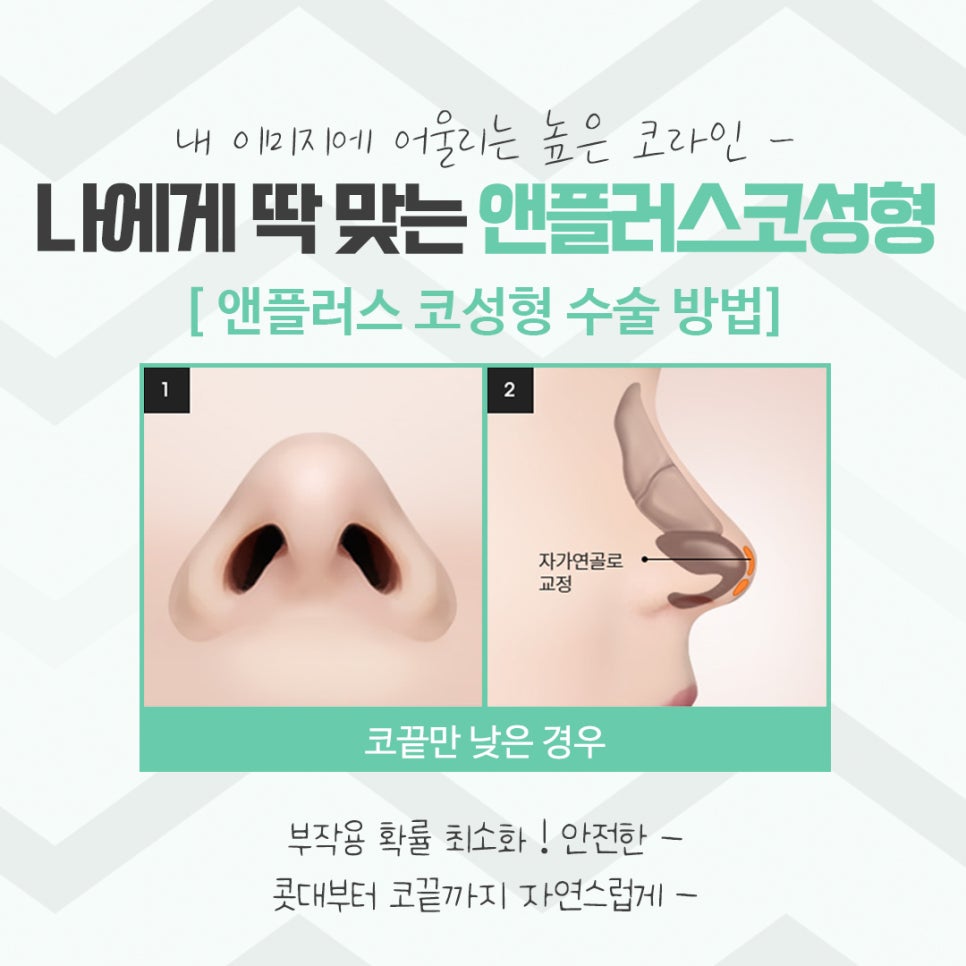 코성형후기 자연스러운 코라인으로 관련 이미지 10
