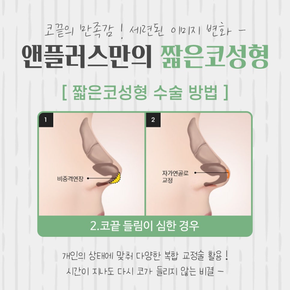 Learn About Short Nose Surgery Properly image 9