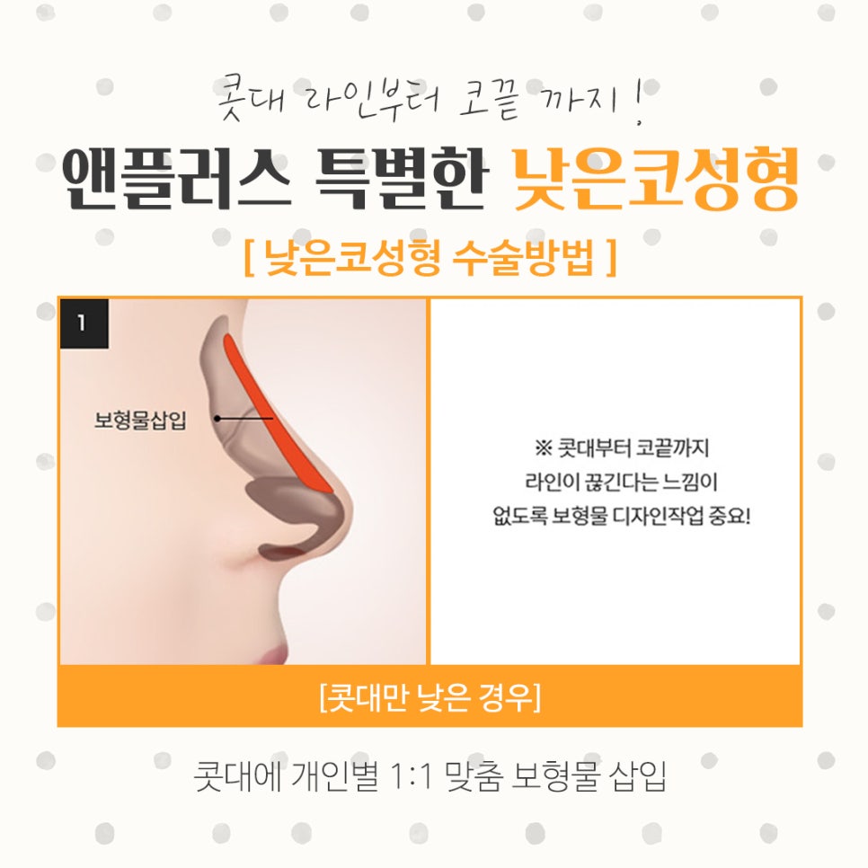 Check the Changes in Low Nose Surgery image 8