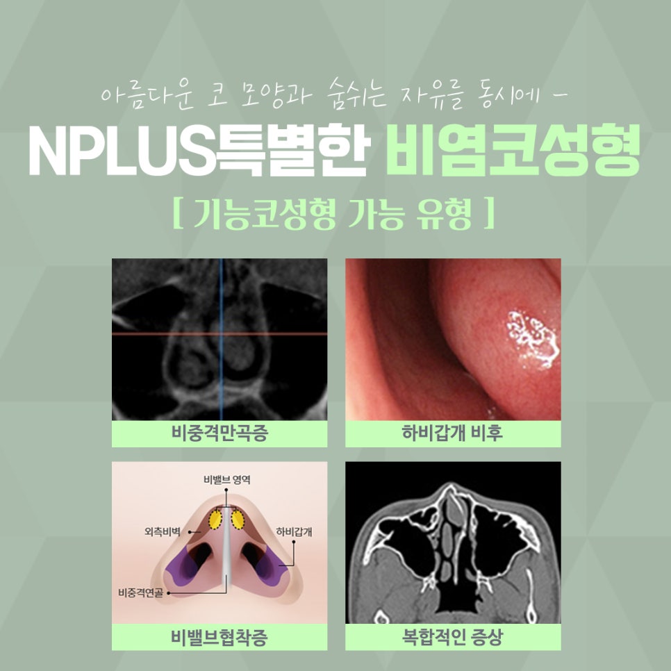 Review of Rhinitis Nose Surgery: Looking for the Differences image 4