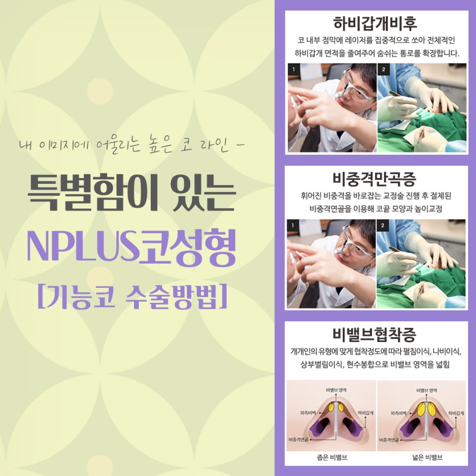 압구정코수술에 대해 찾아보고 관련 이미지 11