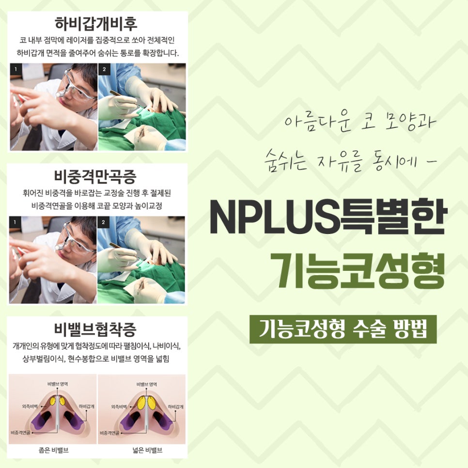 Rhinoplasty for Rhinitis at a Good ENT Clinic image 7