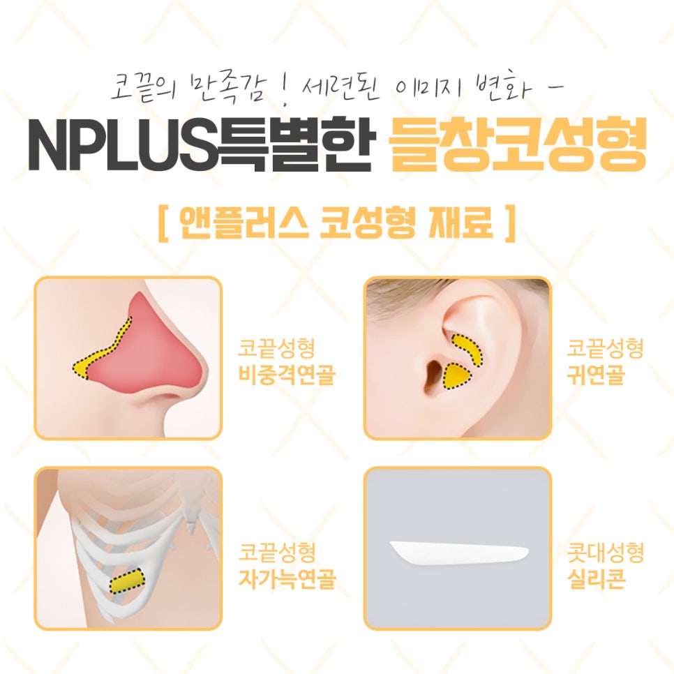들창코수술에 대해 자세하게 알아보고 관련 이미지 11