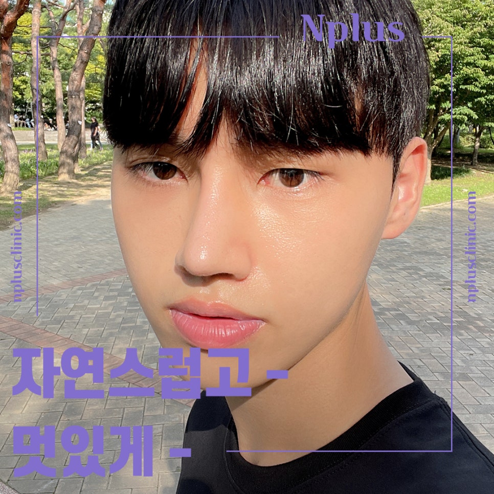 A Nose Line That Suits You, Even in Men's Rhinoplasty Reviews image 11