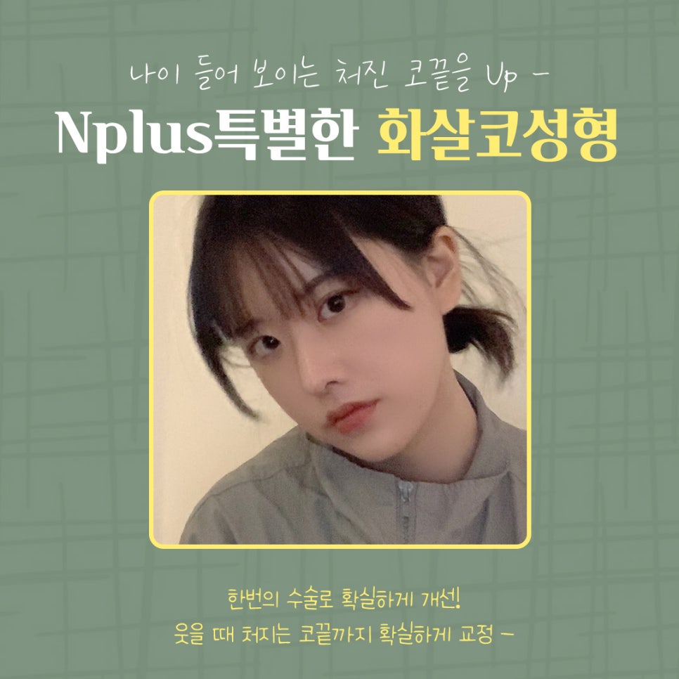 화살코성형 후기까지 확실하게 관련 이미지 3