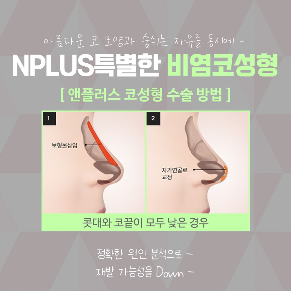 앤플러스에서 알려드리는 잠잘때코막힘 해결 관련 이미지 10