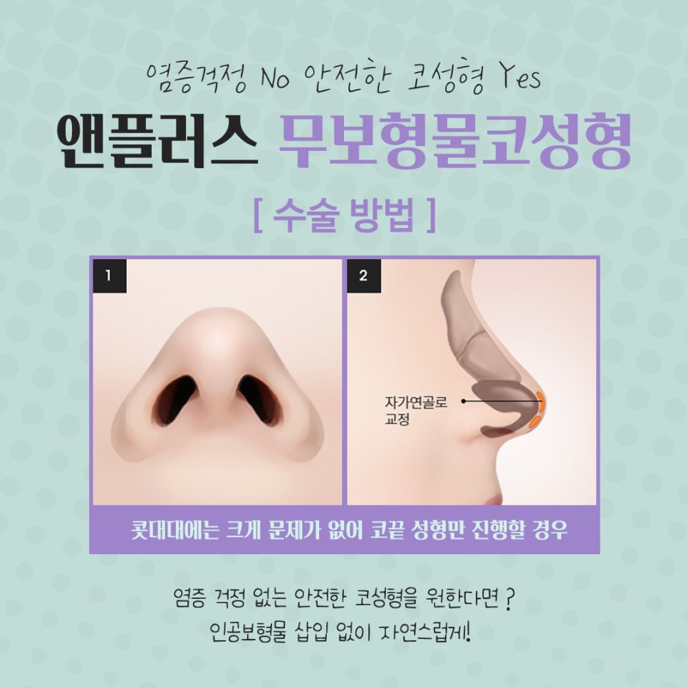 Safety First: Check Reviews of Non-Implant Rhinoplasty image 12