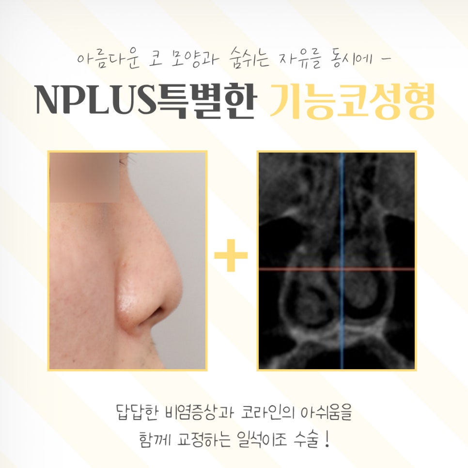 If You’re Looking for Functional Nose Surgery Reviews image 3