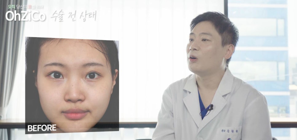 짧은코수술 후기까지 자세하게 알아보고 관련 이미지 2