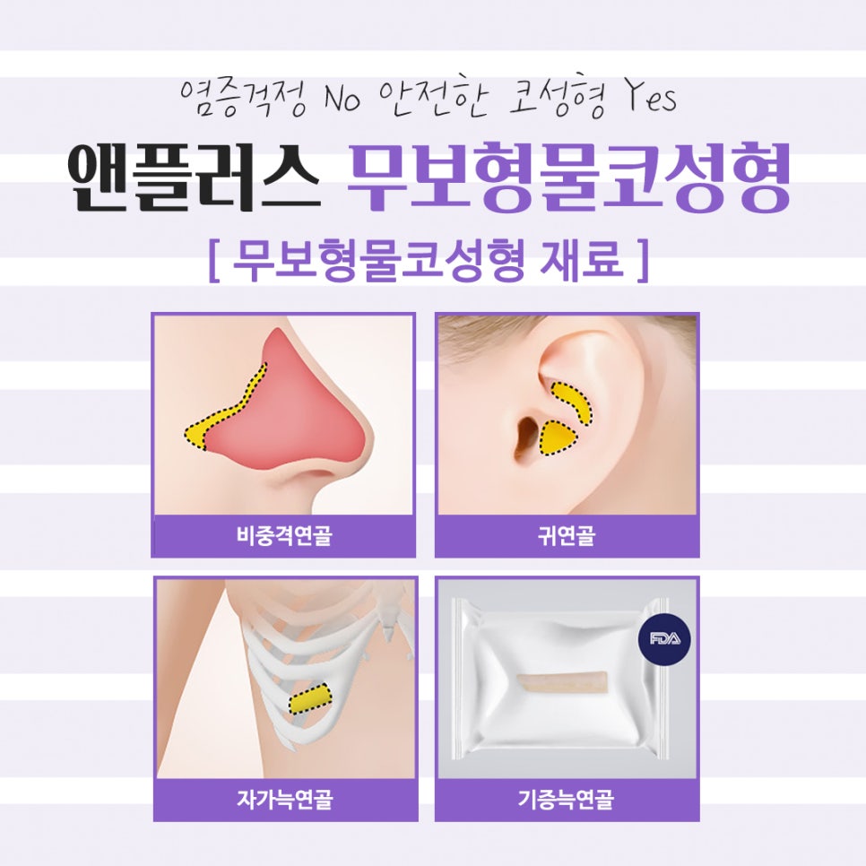 무보형물코성형후기 만족스러운 라인으로 관련 이미지 6