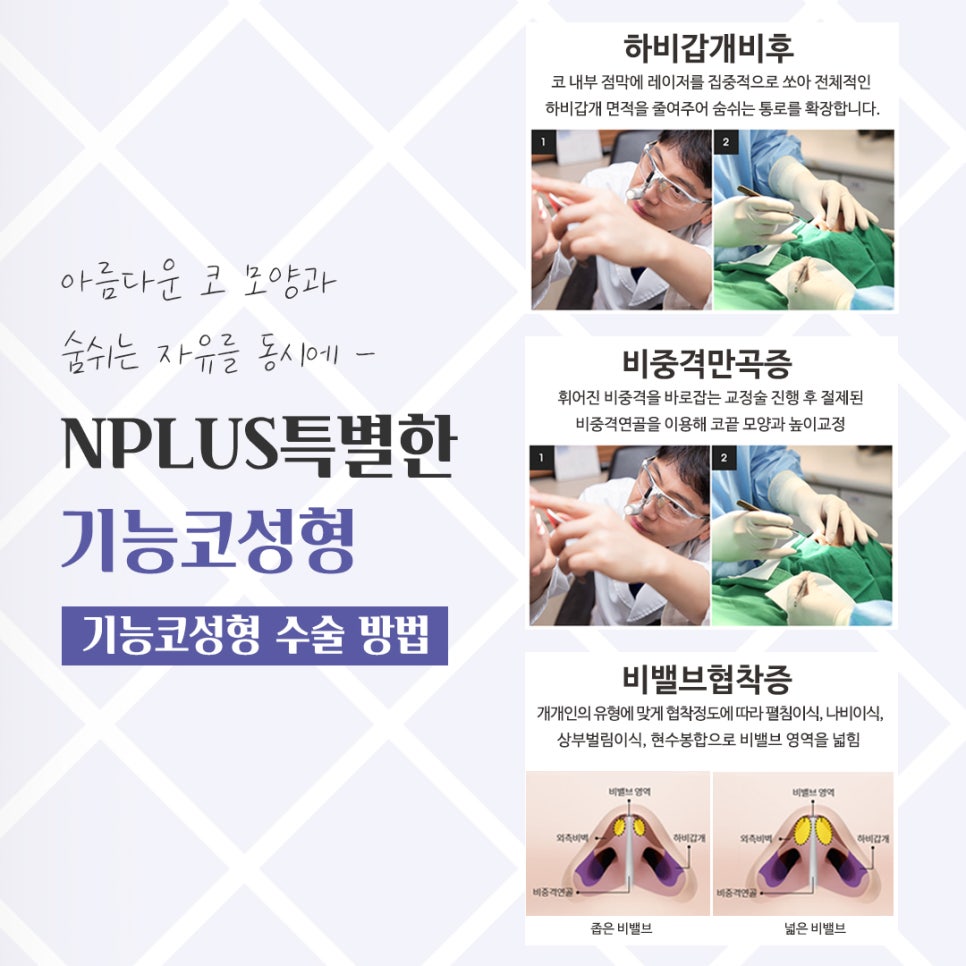 기능코수술후기 잘 알아보고 선택 관련 이미지 9